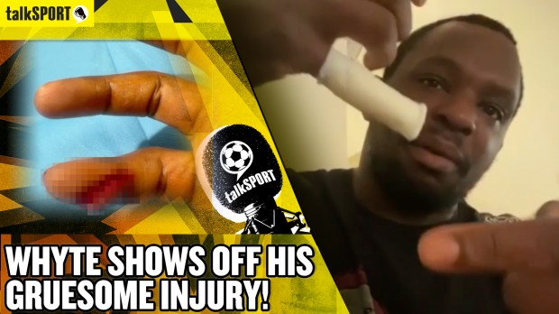 Dillian Whyte shows off gruesome injury and givs update after withdrawing from fight